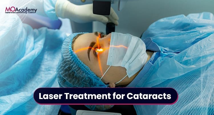 Laser Treatment for Cataracts