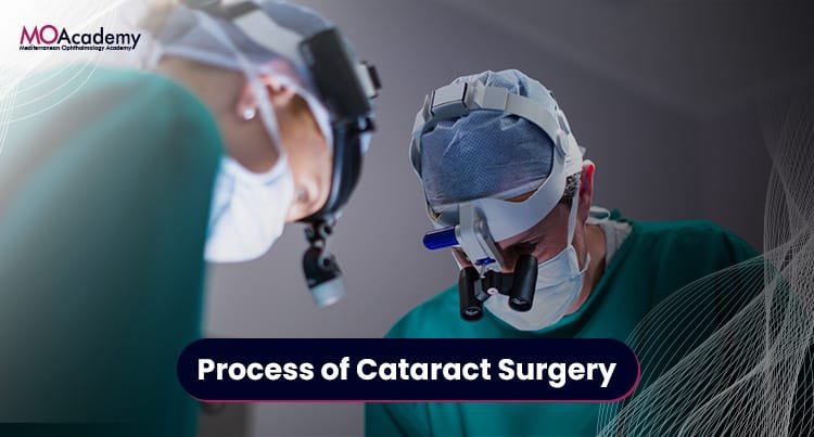 process of cataract surgery